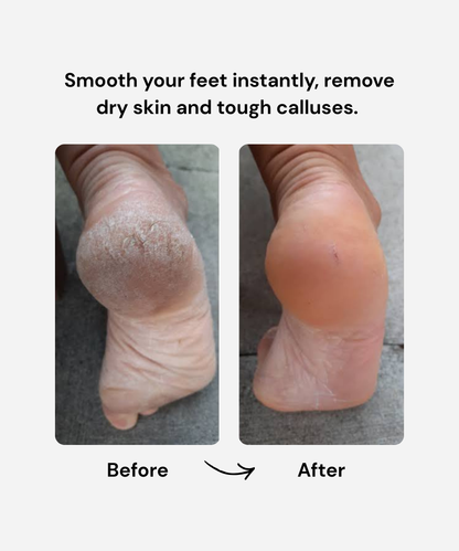 Solara™ Electric File